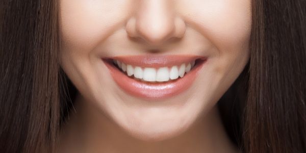 Professional teeth whitening