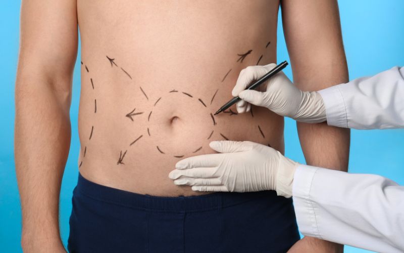 Aesthetic Body Surgery: Understanding the Art of Sculpting Beauty