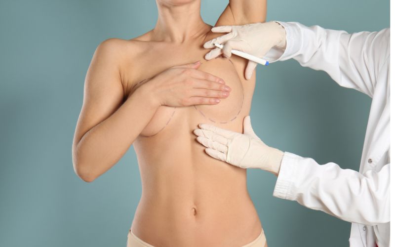 The Science of Breast Aesthetic Surgery: Elevating Confidence