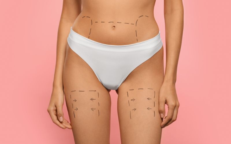 Decoding the Science of Aesthetic Body Surgery: Contours of Beauty